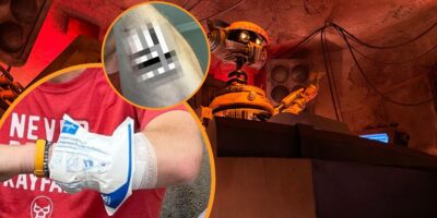 Guest shares photos of injury after falling inside Disneyland.