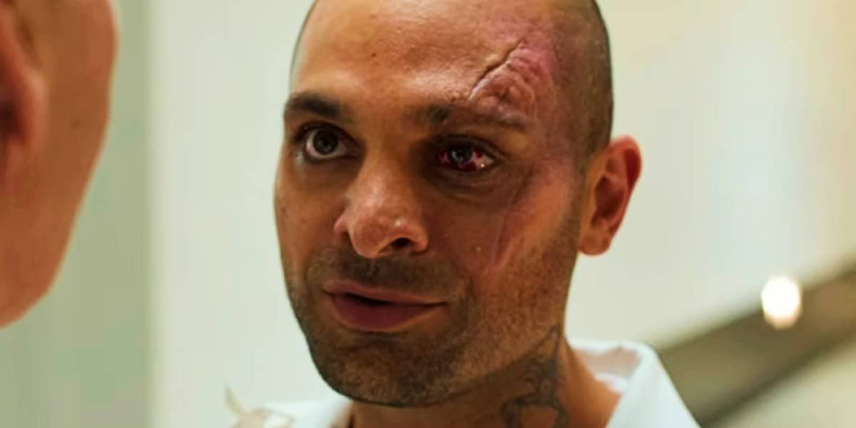Close-up of a man with a bruised face and a shaved head, looking intently at someone off-camera. he has a visible facial tattoo and wears a white shirt.