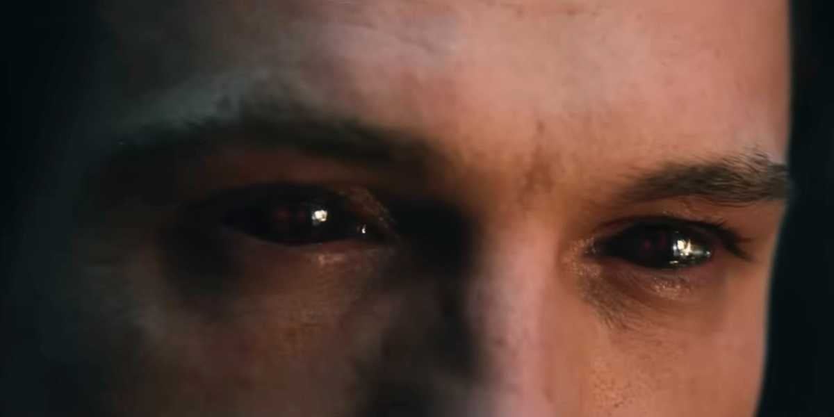 Peter Parker (Tom Holland) with black eyes